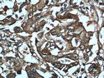 HSP70 Antibody in Immunohistochemistry (Paraffin) (IHC (P))