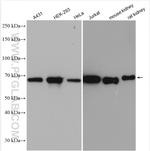 HSP70 Antibody in Western Blot (WB)