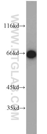 HSP70 Antibody in Western Blot (WB)