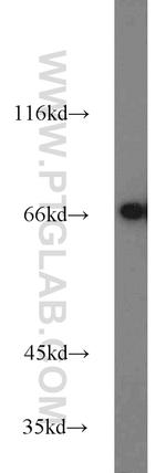 HSP70 Antibody in Western Blot (WB)