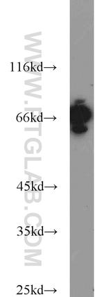 HSP70 Antibody in Western Blot (WB)