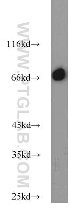 HSP70 Antibody in Western Blot (WB)