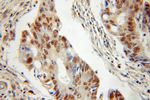 DGCR8 C-terminal Antibody in Immunohistochemistry (Paraffin) (IHC (P))