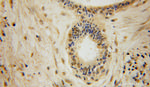 DGCR8 C-terminal Antibody in Immunohistochemistry (Paraffin) (IHC (P))