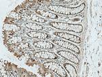 RAB32 Antibody in Immunohistochemistry (Paraffin) (IHC (P))