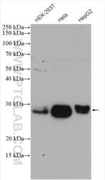 RAB32 Antibody in Western Blot (WB)