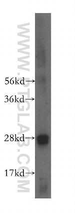 RAB32 Antibody in Western Blot (WB)