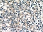 MIPEP Antibody in Immunohistochemistry (Paraffin) (IHC (P))