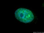 TCOF1 Antibody in Immunocytochemistry (ICC/IF)