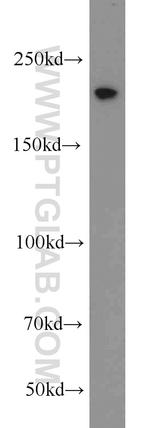 TCOF1 Antibody in Western Blot (WB)