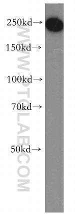 TCOF1 Antibody in Western Blot (WB)