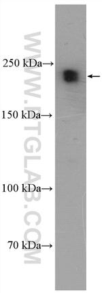 TCOF1 Antibody in Western Blot (WB)