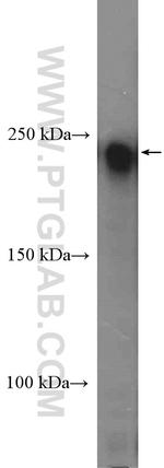 TCOF1 Antibody in Western Blot (WB)