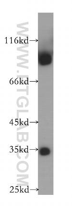 LDB3 Antibody in Western Blot (WB)