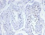 KIF2C (Kinesin Family Member 2C)/MCAK Antibody in Immunohistochemistry (Paraffin) (IHC (P))