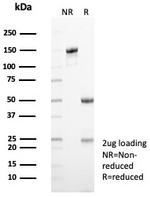 KIF2C (Kinesin Family Member 2C)/MCAK Antibody in SDS-PAGE (SDS-PAGE)