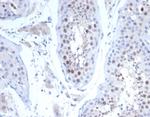 KIF2C (Kinesin Family Member 2C)/MCAK Antibody in Immunohistochemistry (Paraffin) (IHC (P))