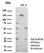 KIF2C (Kinesin Family Member 2C)/MCAK Antibody in SDS-PAGE (SDS-PAGE)