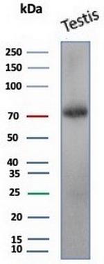 KIF2C (Kinesin Family Member 2C)/MCAK Antibody in Western Blot (WB)