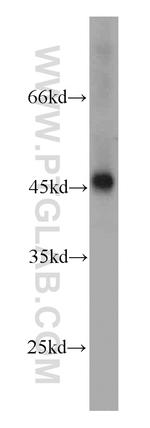 RPL3 Antibody in Western Blot (WB)