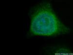 PPAN Antibody in Immunocytochemistry (ICC/IF)