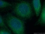 CDK5RAP3 Antibody in Immunocytochemistry (ICC/IF)