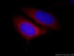 CDK5RAP3 Antibody in Immunocytochemistry (ICC/IF)