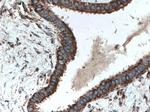 CDK5RAP3 Antibody in Immunohistochemistry (Paraffin) (IHC (P))