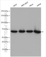 CDK5RAP3 Antibody in Western Blot (WB)