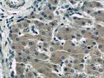 GABARAPL1 Antibody in Immunohistochemistry (Paraffin) (IHC (P))