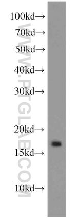 GABARAPL1 Antibody in Western Blot (WB)