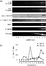 ACSL4 Antibody in Western Blot (WB)