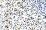 ASF1B Antibody in Immunohistochemistry (Paraffin) (IHC (P))