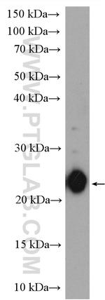 ASF1B Antibody in Western Blot (WB)