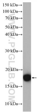 ASF1B Antibody in Western Blot (WB)