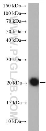 ASF1B Antibody in Western Blot (WB)