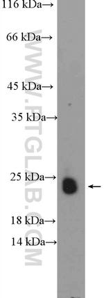 ASF1B Antibody in Western Blot (WB)