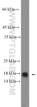 ASF1B Antibody in Western Blot (WB)