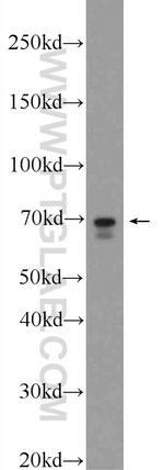 FATP4 Antibody in Western Blot (WB)