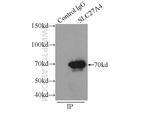 FATP4 Antibody in Immunoprecipitation (IP)