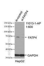 FATP4 Antibody in Western Blot (WB)