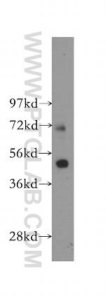 FATP4 Antibody in Western Blot (WB)