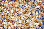 AK2 Antibody in Immunohistochemistry (Paraffin) (IHC (P))