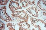 AK2 Antibody in Immunohistochemistry (Paraffin) (IHC (P))