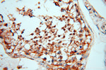 AK2 Antibody in Immunohistochemistry (Paraffin) (IHC (P))