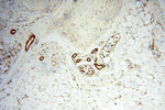 AK2 Antibody in Immunohistochemistry (Paraffin) (IHC (P))