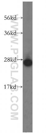 AK2 Antibody in Western Blot (WB)