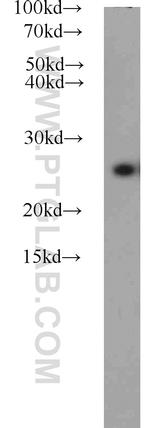 AK2 Antibody in Western Blot (WB)