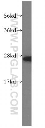 AK2 Antibody in Western Blot (WB)