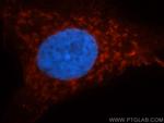 AK2 Antibody in Immunocytochemistry (ICC/IF)